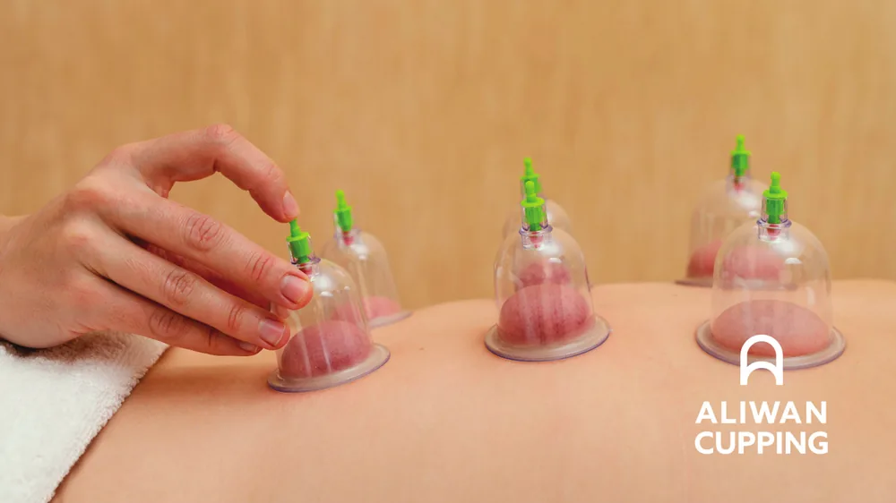 White English logo over a photograph of cupping cups on a person's back
